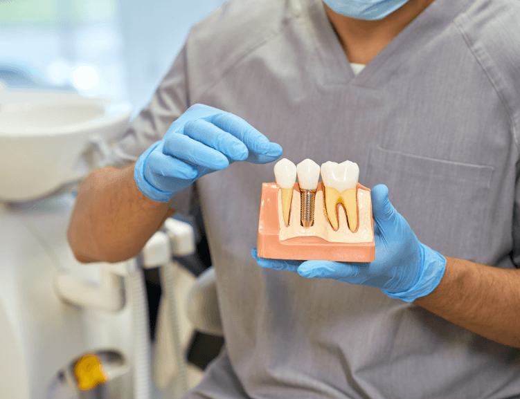 Uşak’ta Uygun Fiyatlı Dental İmplantlar