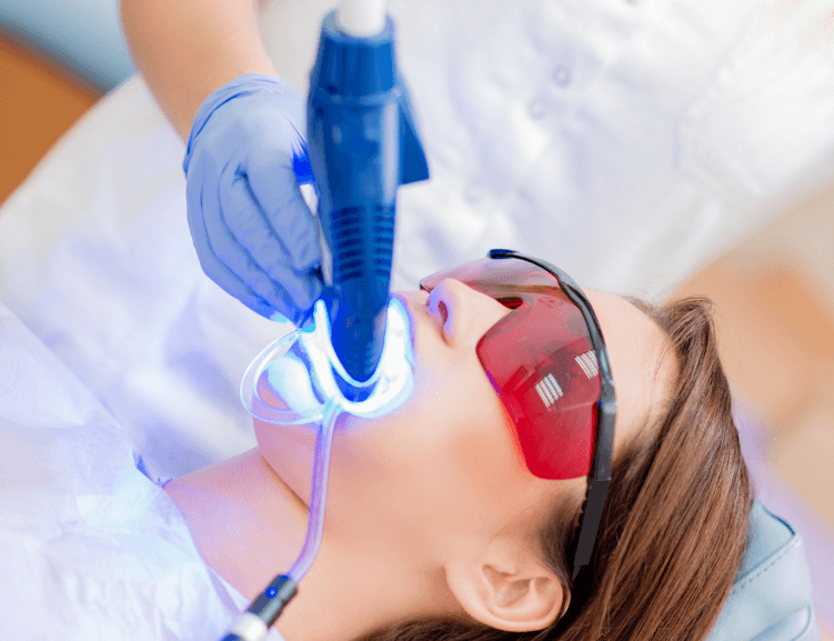 Uşak’ta Uygun Fiyatlı Diş Beyazlatma