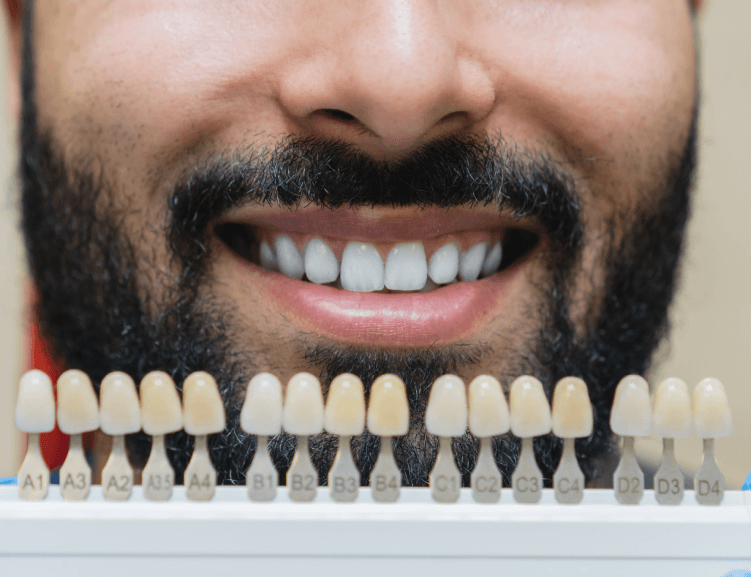 Uşak'ta Profesyonel Diş Beyazlatma