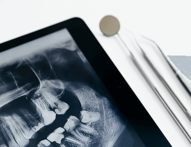 Uşak’ta Güvenilir Çene Ameliyatı