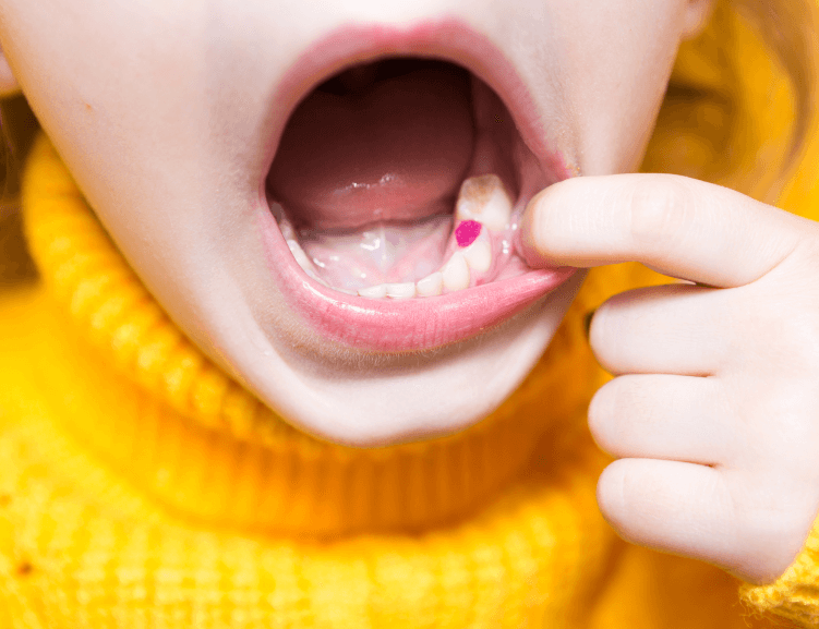 Uzmanlardan Çocuk Diş Hekimliği