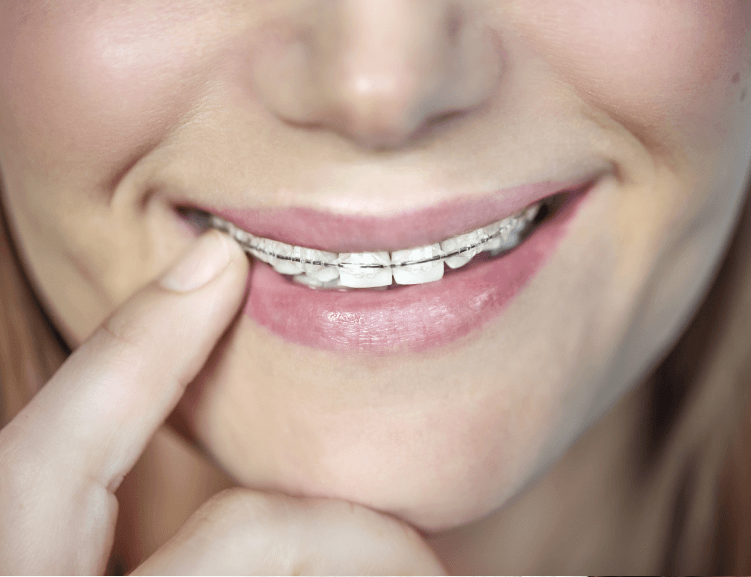 Gelişmiş Estetik Diş Hekimliği Teknikleri