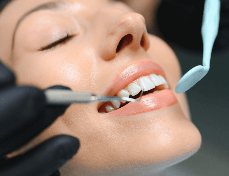 Gelişmiş Laminate Diş Teknikleri